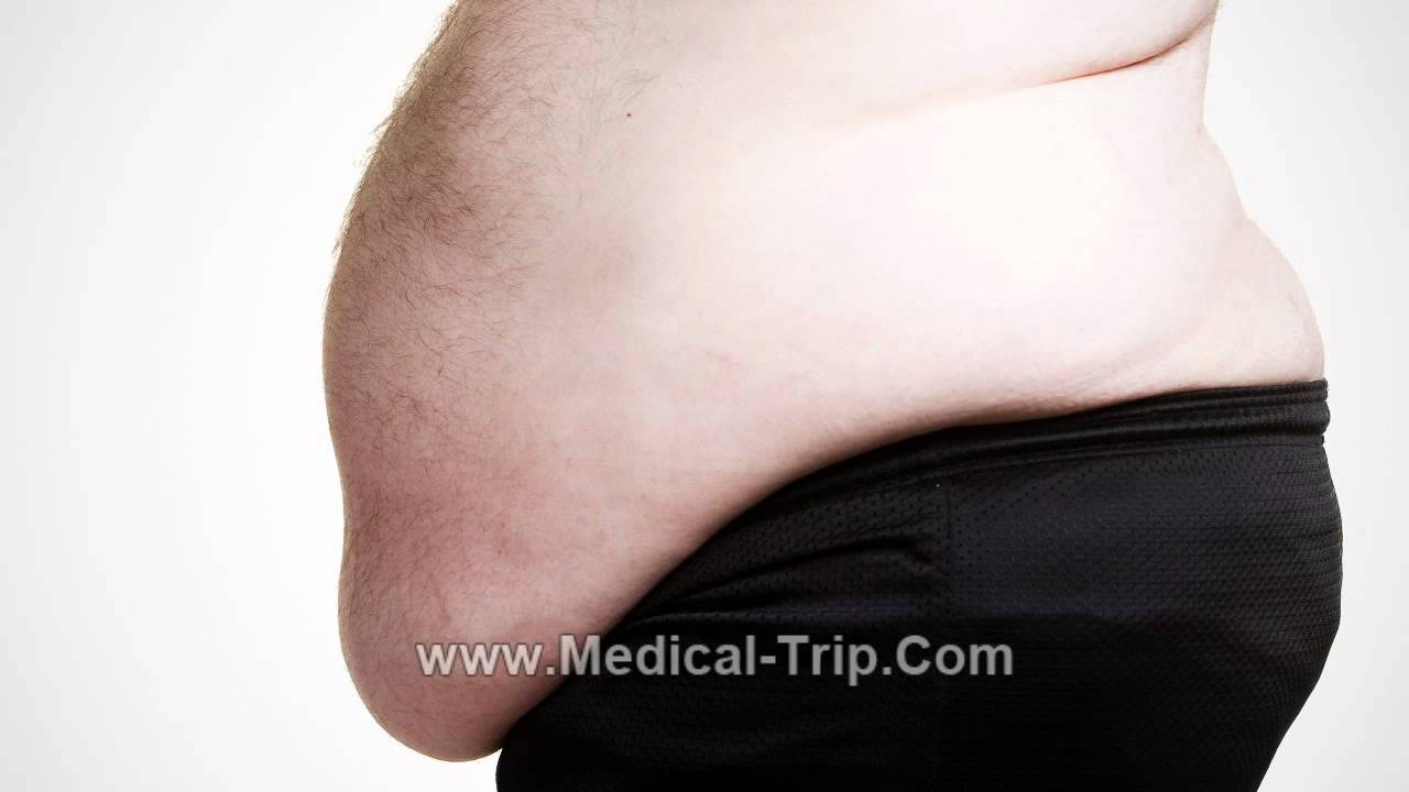 how much is a tummy tuck in mexico city