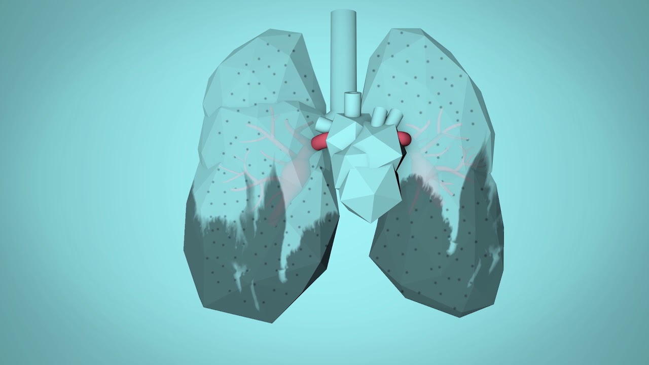 which of these factors is a major reason that there is a high amount of pollution in mexico city?