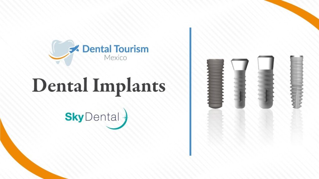 mexico city dental implants