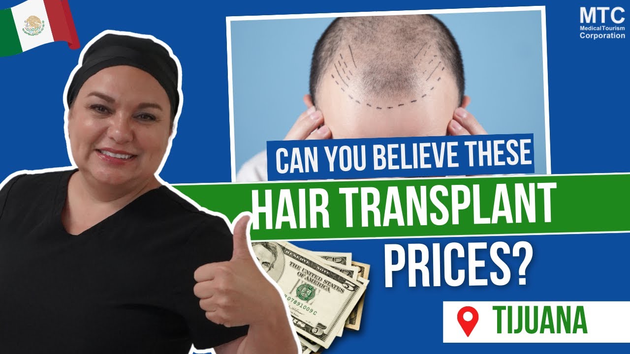 best hair transplant in mexico city